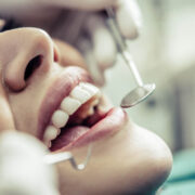 Jak sie przygotowac do pierwszej wizyty u dentysty po dluzszej przerwie